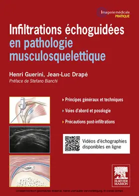 Drapé / Guerini |  Infiltrations échoguidées | eBook | Sack Fachmedien