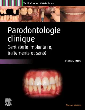 Mora |  Parodontologie clinique | Buch |  Sack Fachmedien
