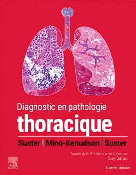 Suster / Mino-Kenudson |  Diagnostic en pathologie thoracique | Buch |  Sack Fachmedien