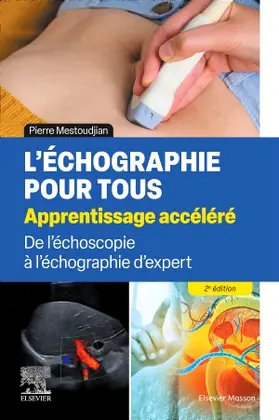 Mestoudjian | L'échographie pour tous : apprentissage accéléré | Buch | 978-2-294-78548-1 | www.sack.de