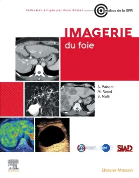 Paisant / Mulé / Ronot |  Imagerie du foie | Buch |  Sack Fachmedien