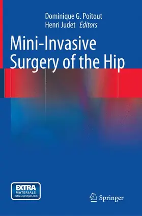 Poitout / Judet | Mini-Invasive Surgery of the Hip | Buch | 978-2-8178-0545-0 | www.sack.de