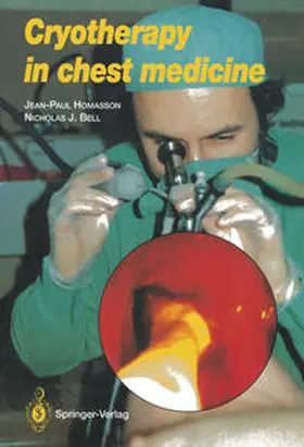 HOMASSON |  Cryotherapy in Chest Medicine | eBook | Sack Fachmedien