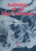 Bret / Cuche / Schmutz |  Radiology of the small intestine | Buch |  Sack Fachmedien