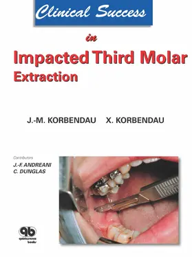 Korbendau |  Clinical Success in Impacted Third Molar Extraction | eBook | Sack Fachmedien