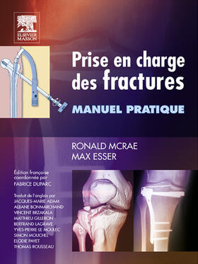 McRae / Esser / Duparc | Prise en charge des fractures | E-Book | sack.de