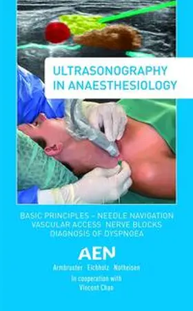 Armbruster / Eichholz / Notheisen |  Ultrasonography in Anaesthesiology | Buch |  Sack Fachmedien