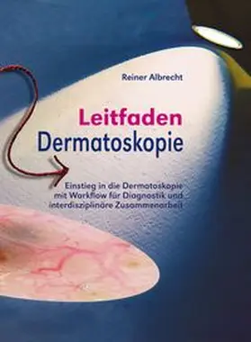 Albrecht |  Leitfaden Dermatoskopie | Buch |  Sack Fachmedien