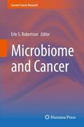 Robertson |  Microbiome and Cancer | Buch |  Sack Fachmedien
