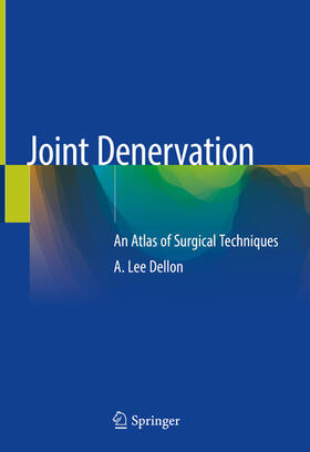 Dellon | Joint Denervation | E-Book | sack.de