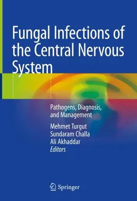 Turgut / Challa / Akhaddar |  Fungal Infections of the Central Nervous System | Buch |  Sack Fachmedien
