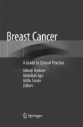Aydiner / Soran / Igci |  Breast Cancer | Buch |  Sack Fachmedien