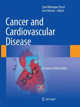 Banchs / Yusuf | Cancer and Cardiovascular Disease | Buch | 978-3-030-09669-4 | sack.de