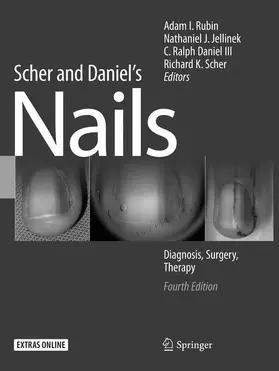 Rubin / Jellinek / Daniel III |  Scher and Daniel's Nails | Buch |  Sack Fachmedien