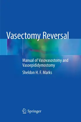 Marks |  Vasectomy Reversal | Buch |  Sack Fachmedien