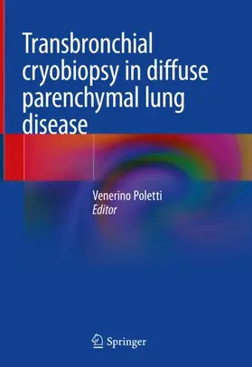 Poletti |  Transbronchial cryobiopsy in diffuse parenchymal lung disease | Buch |  Sack Fachmedien