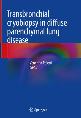 Poletti |  Transbronchial cryobiopsy in diffuse parenchymal lung disease | eBook | Sack Fachmedien