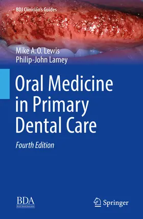 Lewis / Lamey |  Oral Medicine in Primary Dental Care | eBook | Sack Fachmedien