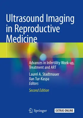 Stadtmauer / Tur-Kaspa | Ultrasound Imaging in Reproductive Medicine | Buch | 978-3-030-16701-1 | www.sack.de