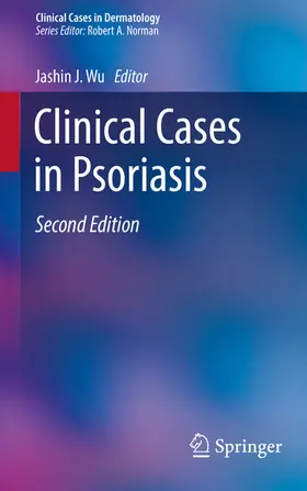 Wu |  Clinical Cases in Psoriasis | eBook | Sack Fachmedien