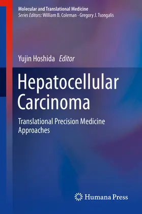 Hoshida |  Hepatocellular Carcinoma | eBook | Sack Fachmedien