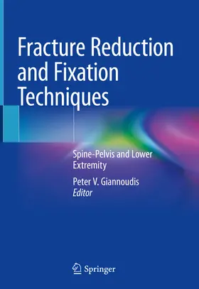 Giannoudis |  Fracture Reduction and Fixation Techniques | eBook | Sack Fachmedien