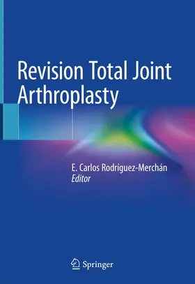 Rodríguez-Merchán | Revision Total Joint Arthroplasty | Buch | 978-3-030-24772-0 | www.sack.de