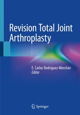 Rodríguez-Merchán | Revision Total Joint Arthroplasty | Buch | 978-3-030-24775-1 | www.sack.de