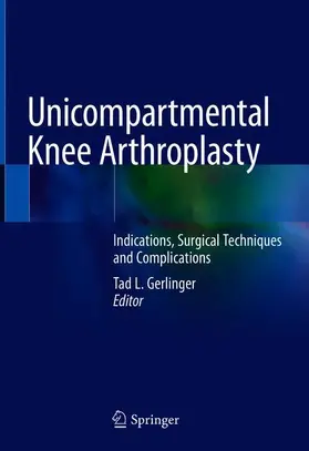 Gerlinger |  Unicompartmental Knee Arthroplasty | Buch |  Sack Fachmedien