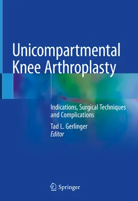 Gerlinger | Unicompartmental Knee Arthroplasty | E-Book | sack.de