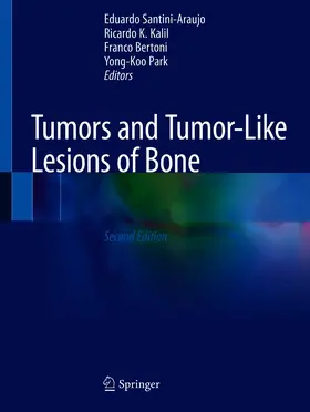Santini-Araujo / Kalil / Bertoni |  Tumors and Tumor-Like Lesions of Bone | eBook | Sack Fachmedien