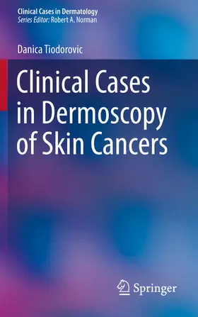 Tiodorovic |  Clinical Cases in Dermoscopy of Skin Cancers | eBook | Sack Fachmedien