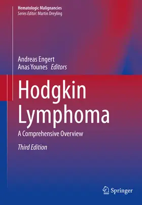 Engert / Younes | Hodgkin Lymphoma | E-Book | sack.de