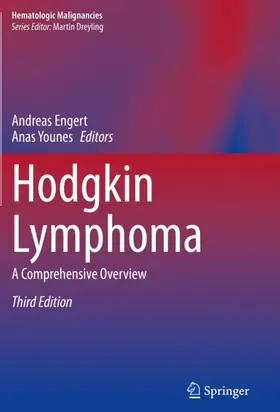 Younes / Engert |  Hodgkin Lymphoma | Buch |  Sack Fachmedien