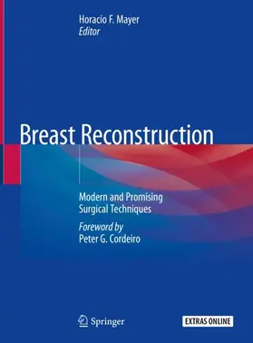 Mayer | Breast Reconstruction | Buch | 978-3-030-34602-7 | sack.de