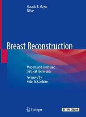 Mayer | Breast Reconstruction | Buch | 978-3-030-34602-7 | sack.de