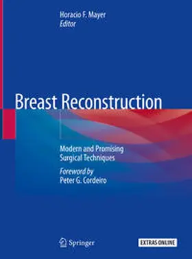 Mayer | Breast Reconstruction | E-Book | sack.de