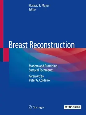 Mayer |  Breast Reconstruction | Buch |  Sack Fachmedien