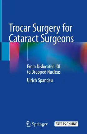 Spandau |  Trocar Surgery for Cataract Surgeons | eBook | Sack Fachmedien