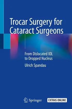 Spandau |  Trocar Surgery for Cataract Surgeons | Buch |  Sack Fachmedien