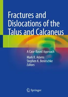 Benirschke / Adams | Fractures and Dislocations of the Talus and Calcaneus | Buch | 978-3-030-37365-8 | www.sack.de