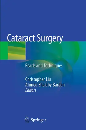 Shalaby Bardan / Liu |  Cataract Surgery | Buch |  Sack Fachmedien