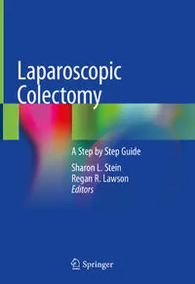 Lawson / Stein |  Laparoscopic Colectomy | Buch |  Sack Fachmedien