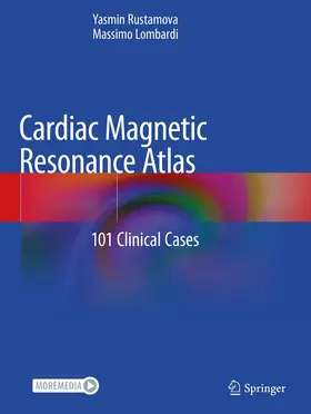 Rustamova / Lombardi |  Cardiac Magnetic Resonance Atlas | Buch |  Sack Fachmedien