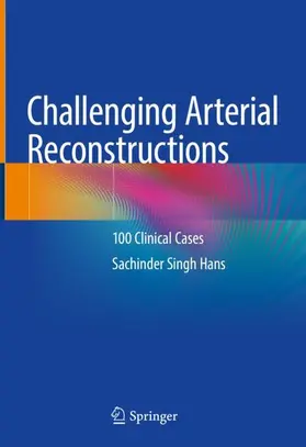 Hans | Challenging Arterial Reconstructions | Buch | 978-3-030-44134-0 | www.sack.de