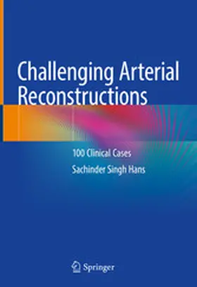 Hans | Challenging Arterial Reconstructions | E-Book | www.sack.de