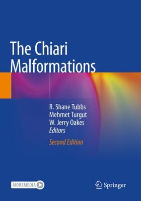 Tubbs / Oakes / Turgut | The Chiari Malformations | Buch | 978-3-030-44864-6 | sack.de