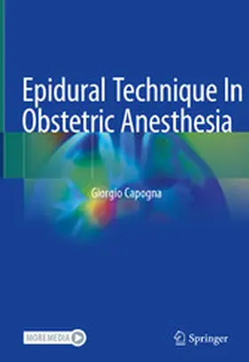 Capogna | Epidural Technique In Obstetric Anesthesia | E-Book | www.sack.de