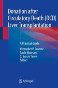 Croome / Taner / Muiesan |  Donation after Circulatory Death (DCD) Liver Transplantation | Buch |  Sack Fachmedien