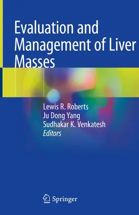 Roberts / Yang / Venkatesh | Evaluation and Management of Liver Masses | Buch | 978-3-030-46698-5 | www.sack.de